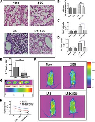 Dietary administration of the glycolytic inhibitor 2-deoxy-D-glucose reduces endotoxemia-induced inflammation and oxidative stress: Implications in PAMP-associated acute and chronic pathology